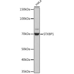 STXBP1 Rabbit mAb