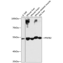 PFKFB2 Rabbit pAb