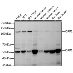 ORP1 Rabbit mAb