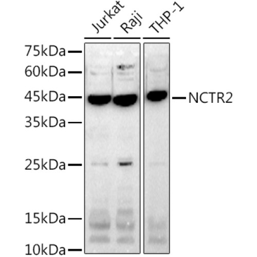 NCTR2 Rabbit mAb