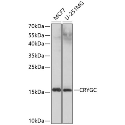 CRYGC Rabbit pAb
