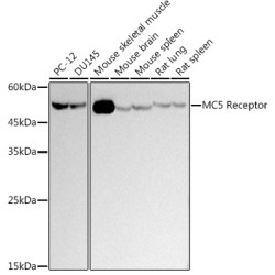 MC5 Receptor Rabbit mAb