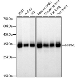 PPP6C Rabbit mAb