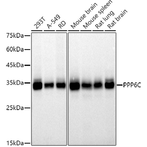 PPP6C Rabbit mAb