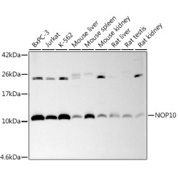 NOP10 Rabbit mAb