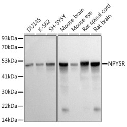 NPY5R Rabbit mAb