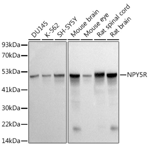 NPY5R Rabbit mAb