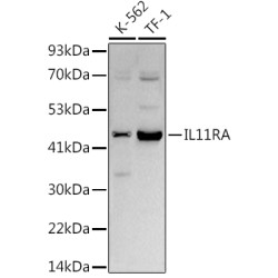 IL11RA Rabbit mAb
