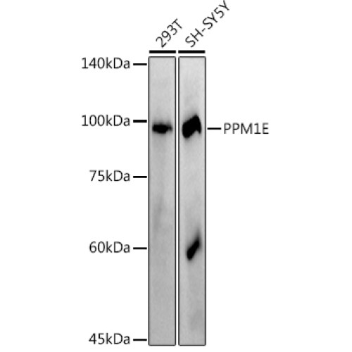 PPM1E Rabbit mAb