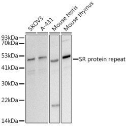 SR protein repeat Rabbit mAb