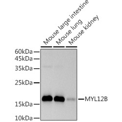 MYL12B Rabbit mAb