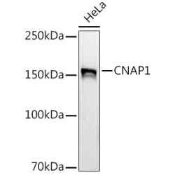 CNAP1 Rabbit mAb