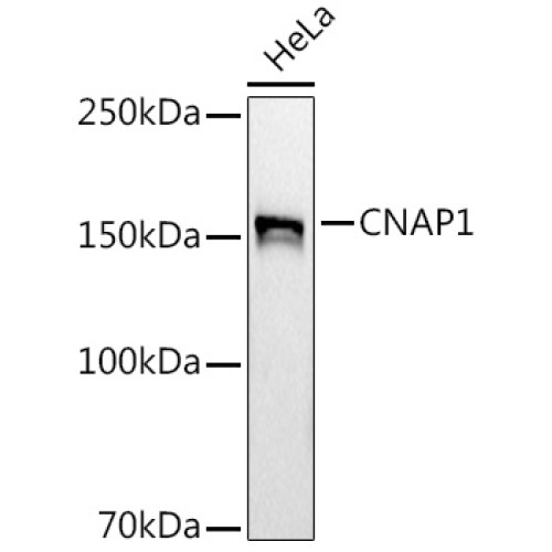 CNAP1 Rabbit mAb