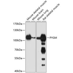 PYGM Rabbit pAb