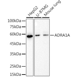 ADRA1A Rabbit mAb