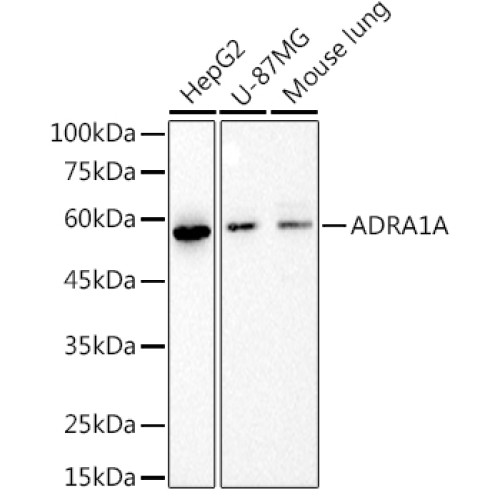 ADRA1A Rabbit mAb