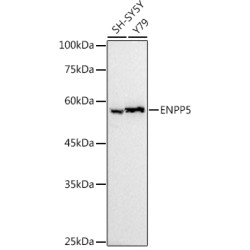 ENPP5 Rabbit mAb