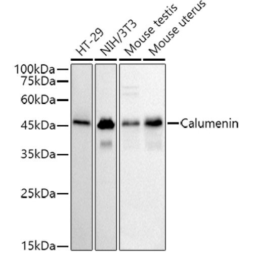 Calumenin Rabbit mAb