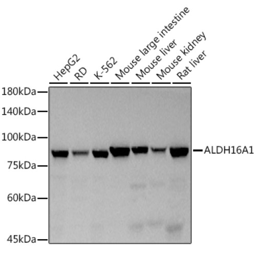 ALDH16A1 Rabbit mAb
