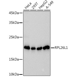 RPL26L1 Rabbit mAb