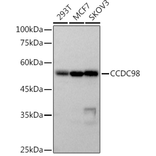 CCDC98 Rabbit mAb