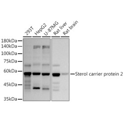 Sterol carrier protein 2 Rabbit mAb