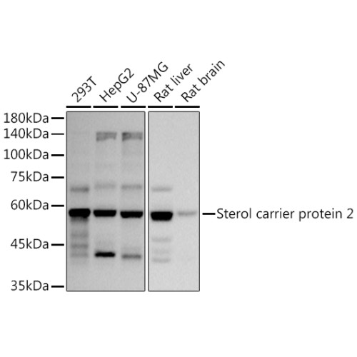 Sterol carrier protein 2 Rabbit mAb