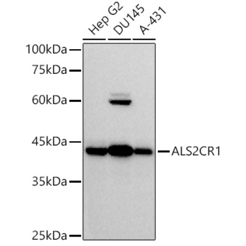 ALS2CR1 Rabbit mAb