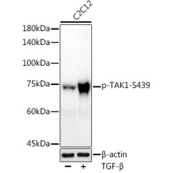 Phospho-TAK1-S439 Rabbit mAb