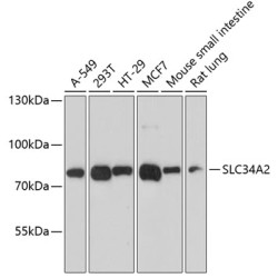 SLC34A2 Rabbit pAb