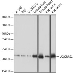 UQCRFS1 Rabbit mAb