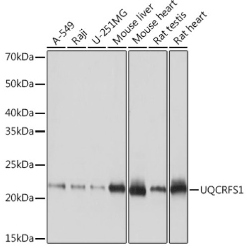 UQCRFS1 Rabbit mAb