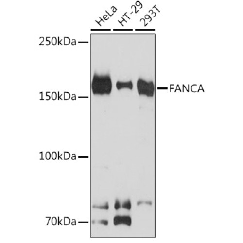 FANCA Rabbit mAb