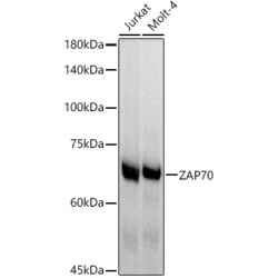ZAP70 Rabbit mAb