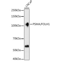 PSMA/FOLH1 Rabbit mAb