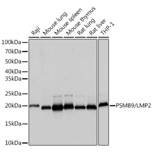 PSMB9/LMP2 Rabbit mAb
