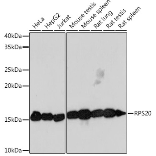 RPS20 Rabbit mAb