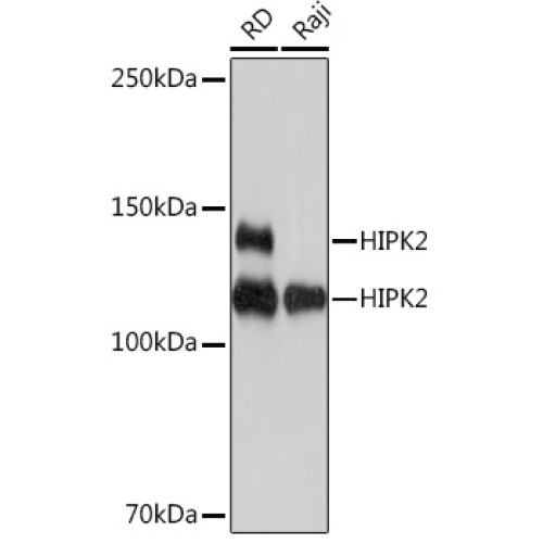 HIPK2 Rabbit mAb