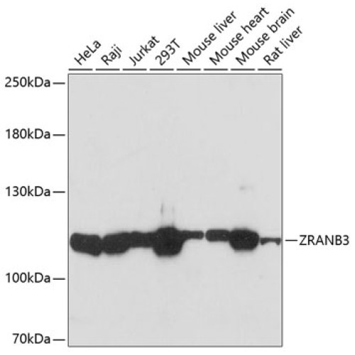 ZRANB3 Rabbit pAb