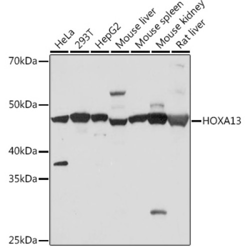 HOXA13 Rabbit mAb