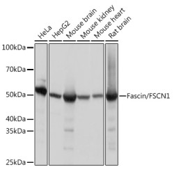Fascin/FSCN1 Rabbit mAb
