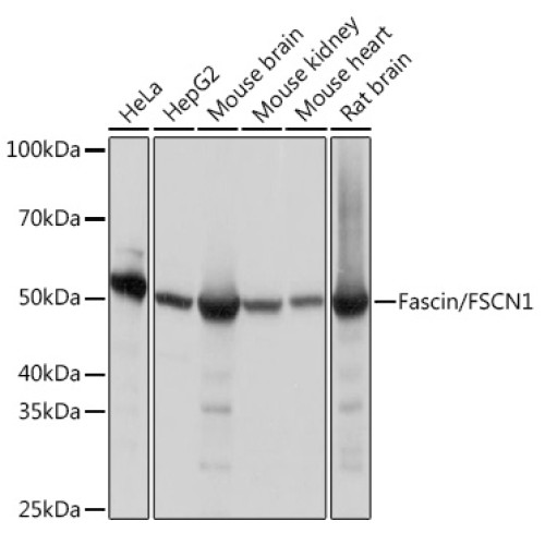 Fascin/FSCN1 Rabbit mAb