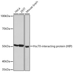 Hsc70-interacting protein (HIP) Rabbit mAb