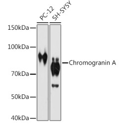 Chromogranin A Rabbit mAb