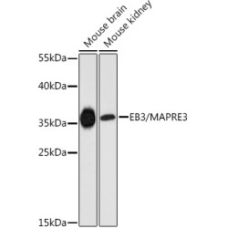 EB3/MAPRE3 Rabbit pAb