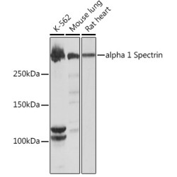alpha 1 Spectrin Rabbit mAb