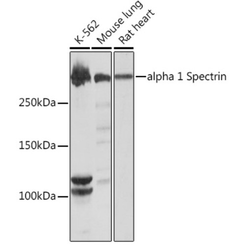 alpha 1 Spectrin Rabbit mAb