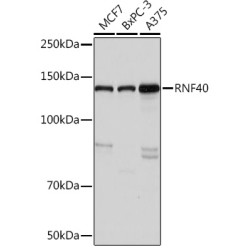 RNF40 Rabbit mAb