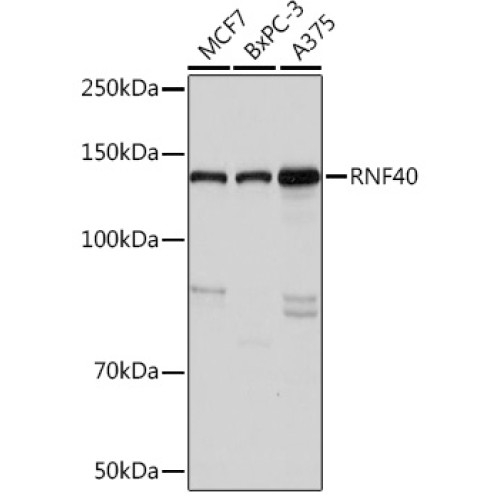 RNF40 Rabbit mAb