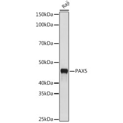 PAX5 Rabbit mAb